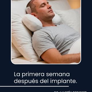 La primera semana después del implante: lo que nadie te cuenta.

Después de un implante capilar con 