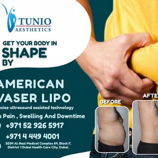 worried about being over weight?
Visit Tunio Aesthetics (DUBAI)

Dr. Zulfiqar H. TUNIO FRCS Glasgow 