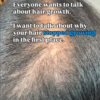 If your hair has become thinner…
If you’re shedding more than usual…
If your ponytail isn’t as full 