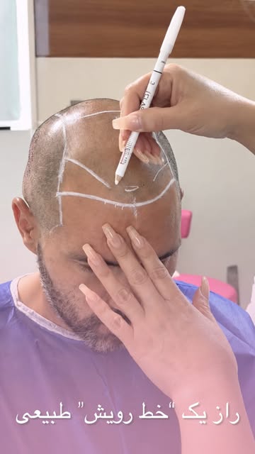 راز خط رویش طبیعی فقط پر کردن قسمت‌های خالی نیست! 👀✨

البته که سلیقه و نظر شما اولویته ولی طراحی خط