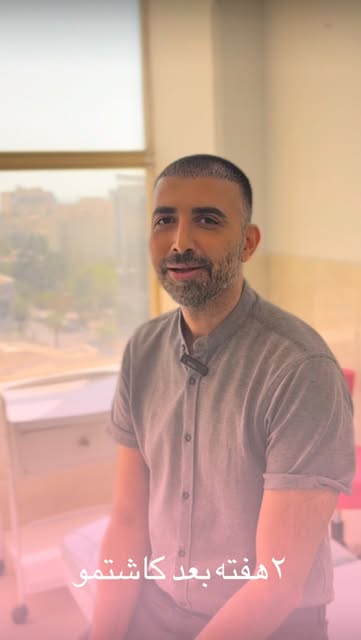 کلاینت کاشتموی عزیزمون بعد ۲هفته جهت ویزیت تشریف آوردن
توضیحات و رضایتشون رو در این ویدیو میبینیم…
ر