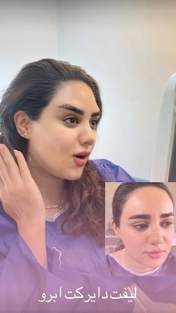 میخوای چشمات کشیده شه بدون لیفت شقیقه؟؟؟ دایرکت بهترین انتخابه فقط تو ۱ ساعت این همه تغییر میکنی🥰
ت