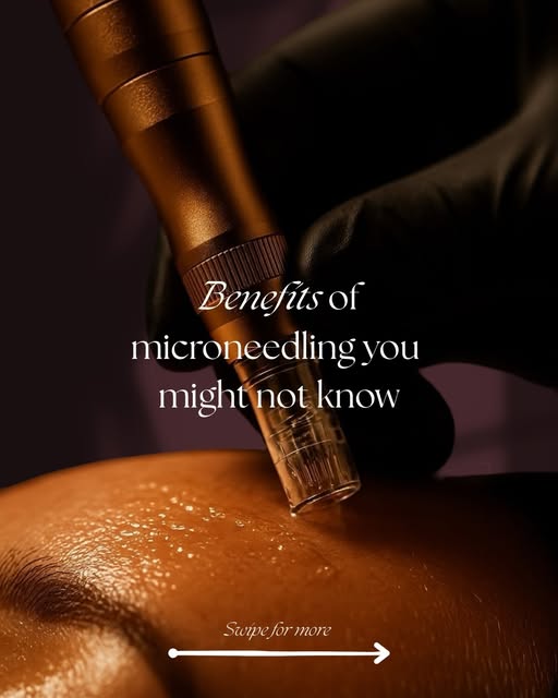 A little prick, a lot of progress. 👀

Microneedling — because your skin’s glow-up deserves a strate