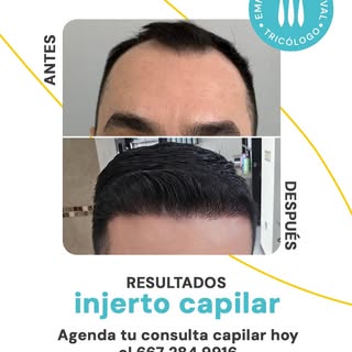 Trabajo con protocolos personalizados, buscando siempre resultados reales y seguros.
Si estás listo 