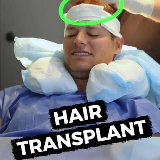 Thinking about a hair transplant but not sure if it’s right for you? 🤔 Dr. Harris takes a relaxed, 