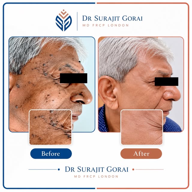 ✨ Clear, healthy-looking skin doesn’t have an expiry date. ✨

Age is not a burden. And getting older