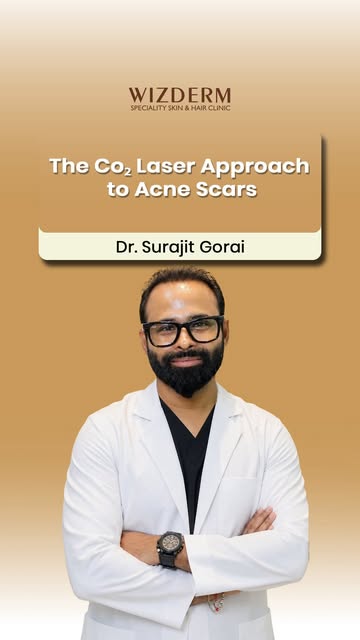 Clearer skin, renewed confidence ✨
Acne and acne scars can be treated with advanced CO₂ Laser treatm