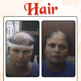 Turn back time and rediscover the best version of yourself with a transformative hair transplant at 