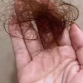 Seu cabelo não para de cair e você já não sabe mais o que fazer? Temos a solução para VOCÊ!!! 

Cons