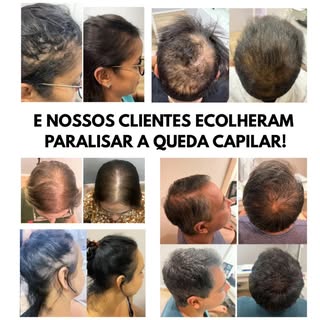 Atenção: 

Imagens reais, não tem pegadinha. 

A única pegadinha é você ficar empurrando com a barri