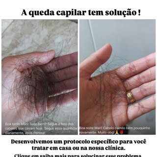 Coisa chata e preocupante é ver o cabelo caindo né?! E sim vice tem razão em se preocupar, cabelo é 