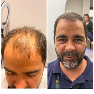 Eu também fico impressionada com esse antes e depois.

Quando o Rômulo @romulocedrocorretor  chegou 