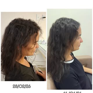 Queda capilar , afinamento , baixo crescimento ?

Seu cabelo não precisa de mais um produto. Precisa