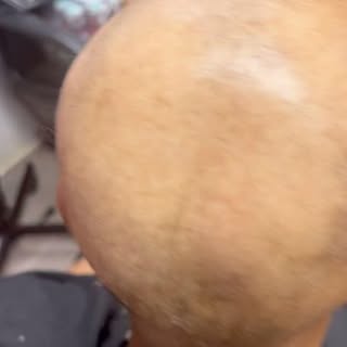 This is My calling ❤️🙏🏽. Alopecia? No problem….This is a full lace unit. I have several units to c