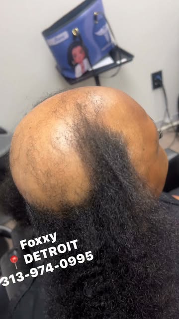 Hair loss doesn’t mean you have to give up the styles you love. ❤️

This time we switched it up with