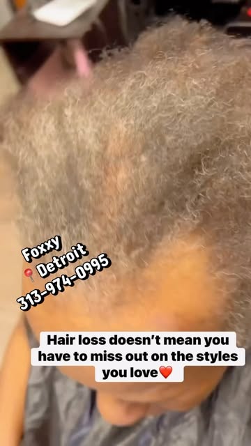 A little thinning? Okay… but we still have a wedding to get ready for! 💃🏽

Hair loss doesn’t mean 