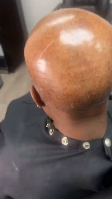 Complete hair loss. Complete transformation. ✨
You still have OPTIONS. 👑

📍 Detroit, MI
📞 313-974
