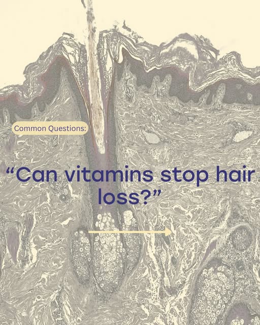 Can vitamins stop hair loss?

It’s a common question but the answer isn’t as simple as taking your h