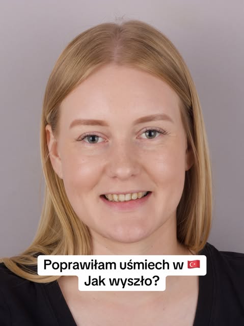 Piłowanie zębów, ekstrakcja ósemki i leczenie kanałowe przebiegły całkowicie bezboleśnie — dzięki ws