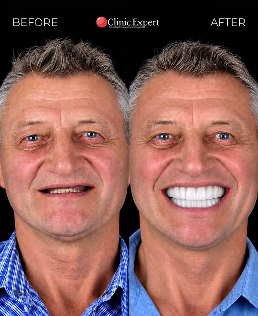 WAIT... that’s the after? 👀
Keep swiping. The real transformation is coming.

#dentaltreatment #den
