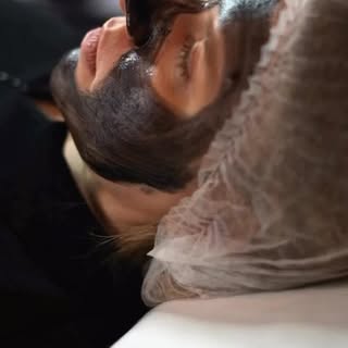 #carbonpeel #qswitchndyaglaser 

🩺 Dr. Kenit Ardeshna
🧚 PARI SKIN & HAIR CLINIC
🌍 RK Prime PLUS, 