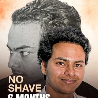 6 Months In: A Seamless No Shave Hair Transplant Transformation

Tired of dealing with 1 to 2 years 