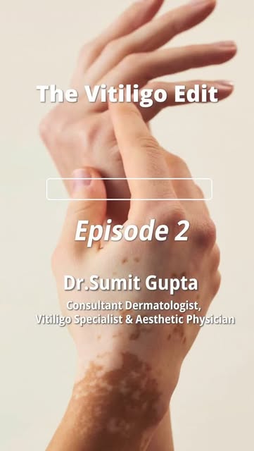 In this Q&A, Dr. Sumit answers some of the most common questions around food and vitiligo, separatin