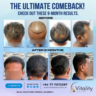 The Ultimate Comeback! 🚀

Check out these incredible results just 9 months after treatment. Real tr