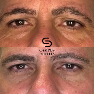 ✨ Una mirada que lo cambia todo

A veces, el cansancio no refleja cómo te sientes… pero sí cómo te v