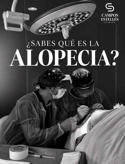 🧬 ¿SABES QUÉ ES LA ALOPECIA?

La alopecia es la pérdida anormal o progresiva del cabello. Puede apa