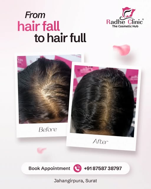 Wider hair parting and visible scalp? Hair thinning doesn’t reverse on its own—look at this transfor