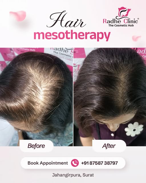 Seeing your scalp through your hair? Reverse thinning before roots permanently fade! ✨

Widening par