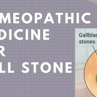 Gallstones - Symptoms and causes, gallstones treatment in homeopathic medicine.

Read More: https://