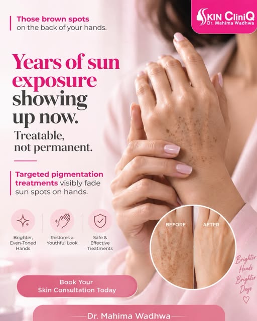 Years of driving without sunscreen on your hands, walking outdoors without a second thought, hands s