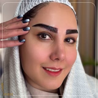 ورق بزنید …

کاشت ابرو نچرال به سبک و روش سمر😍
چشم و ابرو تأثیر زیادی روی زیبایی چهره داره، با یک ک