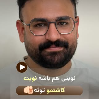 ⁨	نتیجه‌ای که می‌بینید، حاصل طراحی دقیق خط رویش، کاشت اصولی و حفظ خواب طبیعی موهاست.😍👌👌
.
اگر ریز