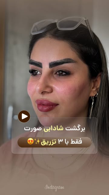 ⁨	توهم همچین تغییری میخوای⁉️🫣😍
.
با یک مشاوره دقیق و تزریق اصولی میتونی توهم همچین نتیجه جذابی بگی