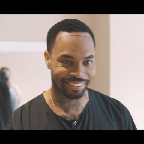Best Hair Transplant Doctor | 1-2 Vip Operation per day | @_kingtrell @stet2.0 

 .
📞📱
.
🇬🇧🇪🇸�