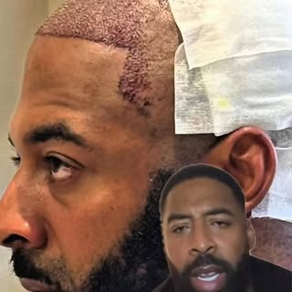 Today marks 8 months since my hair transplant! My original hair is growing very well due to my new h