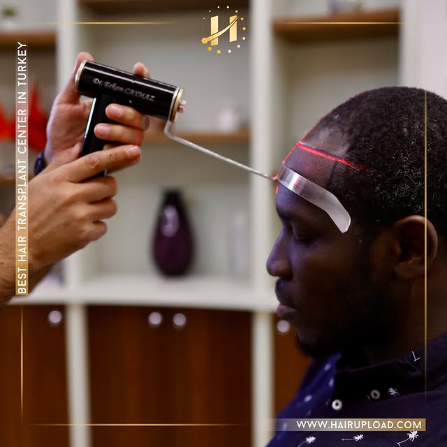 🔥 What if your new hair looked better than your old one? 🔥

Reclaim your confidence with Istanbul’
