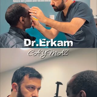 ✨ **Transform Your Look with Istanbul’s Hair Restoration Master!** ✨ 

🌍 **World-Class Expertise in