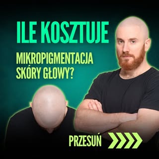 Ile kosztuje #mikropigmentacjaskórygłowy ❓skorzystaj z kalkulatora na mojej stronie i nie miej więce