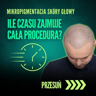 Ile czasu zajmuje zabieg #mikropigmentacjaskórygłowy #sposóbnałysienie#scalpmicropigmentation#włosy#