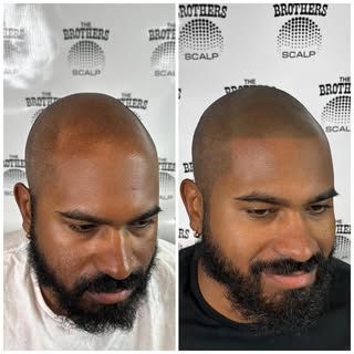 Amazing change from the first session only with The Brothers Scalp. 
Locations: Houston📍Dallas📍
On