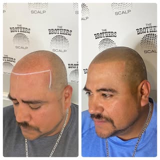 Another satisfied client! 🤝

Book your free consultation appointment today. DM us for any questions
