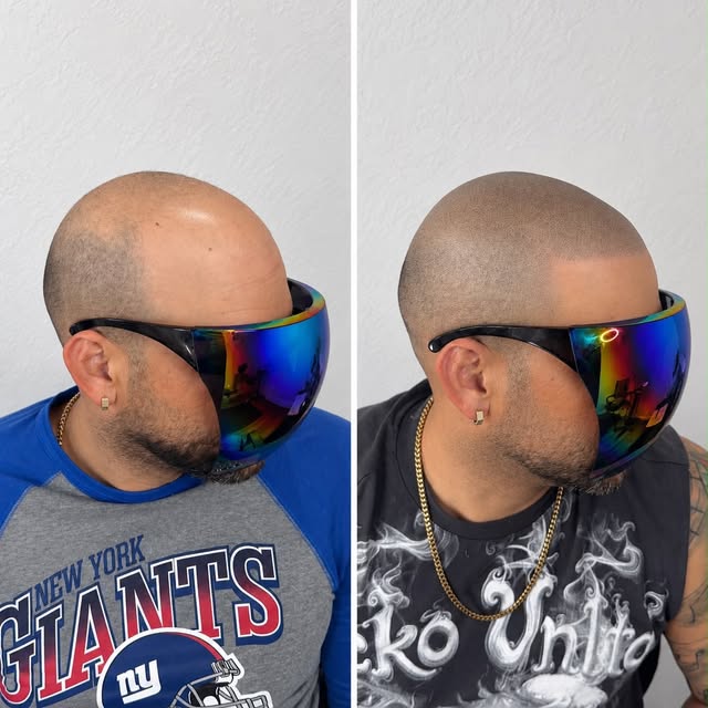 Houston check out this transformation In just a few sessions, we restored density, style, and confid