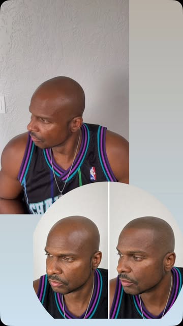 We recreates the appearance of natural hair follicles to restore a defined hairline and the look of 