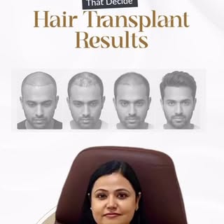 ✨ Thinking about a hair transplant? The success of a hair transplant depends on much more than just 