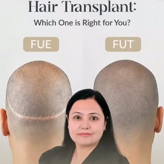 ✨ Hair transplant doesn't end with the procedure; proper aftercare is just as important for the best