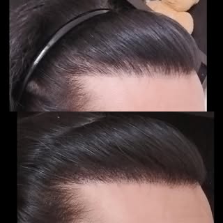 A light top up to reinforce this gents hairline yesterday. This is a great example of how smp can su